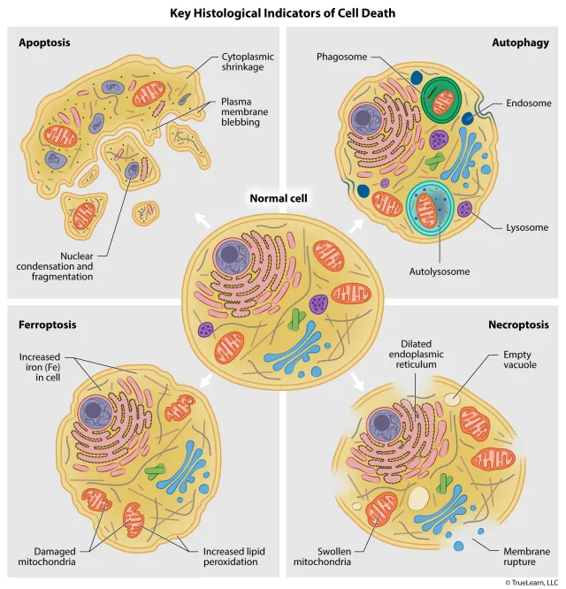 Illustration comparing the visual indicators of apoptosis, autophagy, ferroptosis, and necroptosis. Created as an employee of TrueLearn, LLC. Image used with permission. 