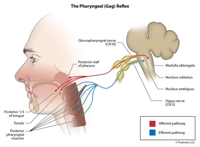 Illustration showing the afferent and efferent pathways involved in the gag reflex. Created as an employee of TrueLearn, LLC. Image used with permission. 