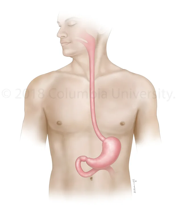 Illustration showing where the esophagus and stomach are located in relation to the neck and torso for the Pancreas Center at Columbia University Medical Center. Created as an employee of the Columbia University Medical Center Department of Surgery. Image used with permission from Columbia University. 