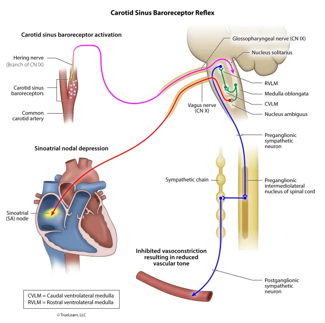 Diagrammatic illustration of the carotid sinus baroreceptor reflex and the anatomy involved. Created as an employee of TrueLearn, LLC. Image used with permission. 