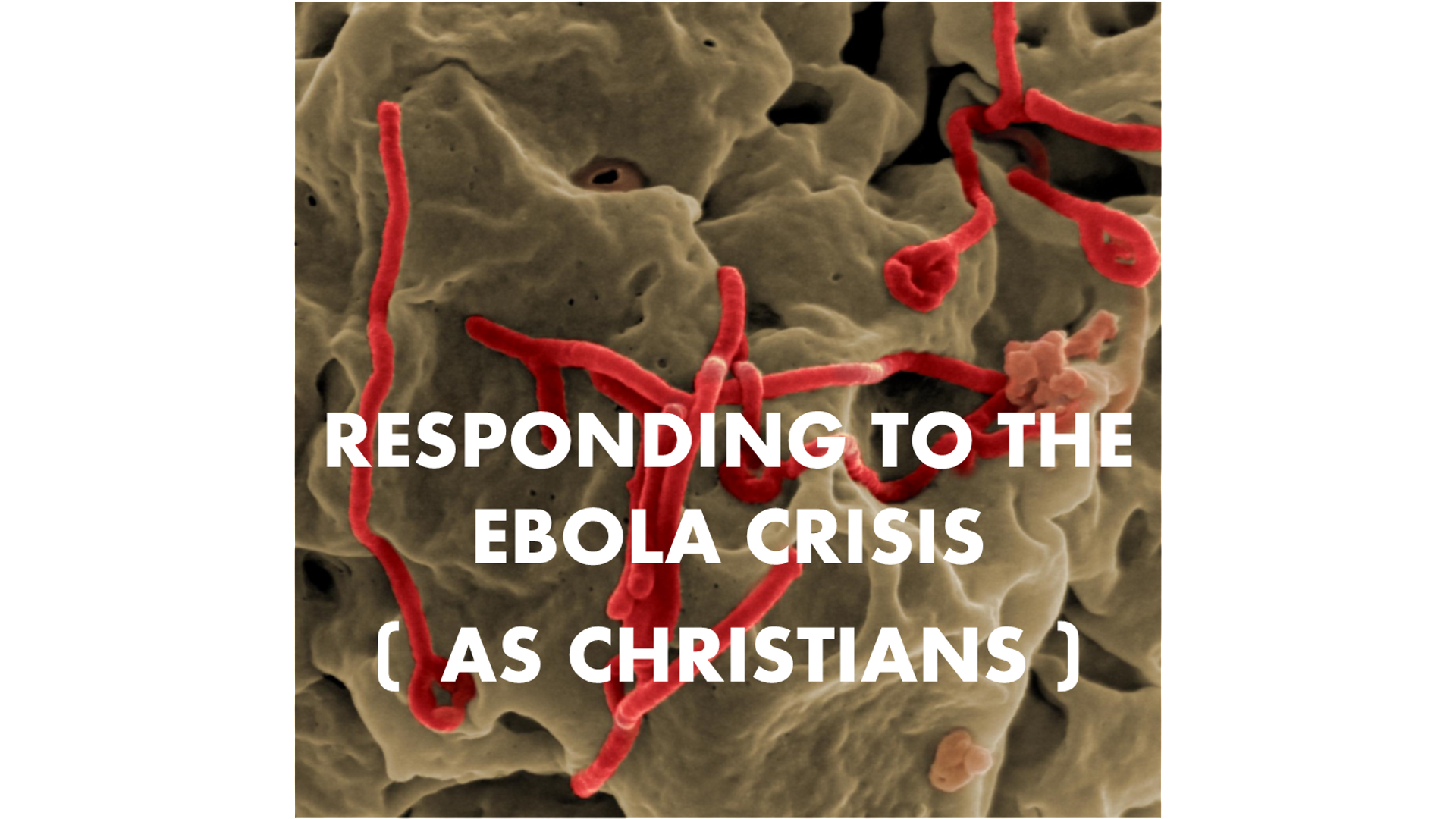 Ebola Arrives in Dallas: How Can Christians at Watermark Respond? Hero Image