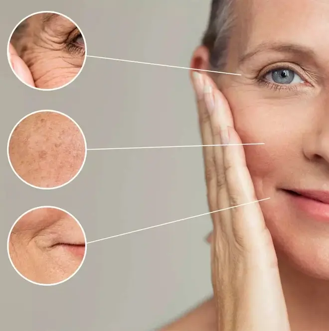 HRT as an Anti-Aging Treatment for Your Skin