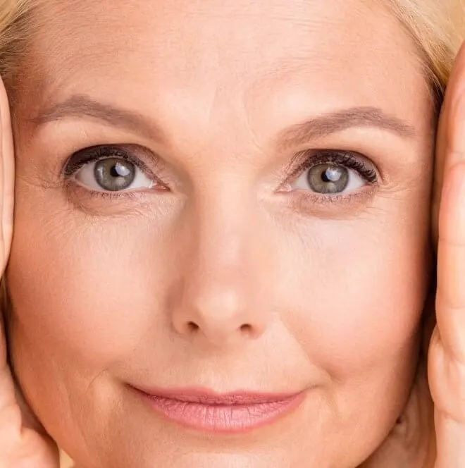 Closeup of a woman holding her face - acne treatments
