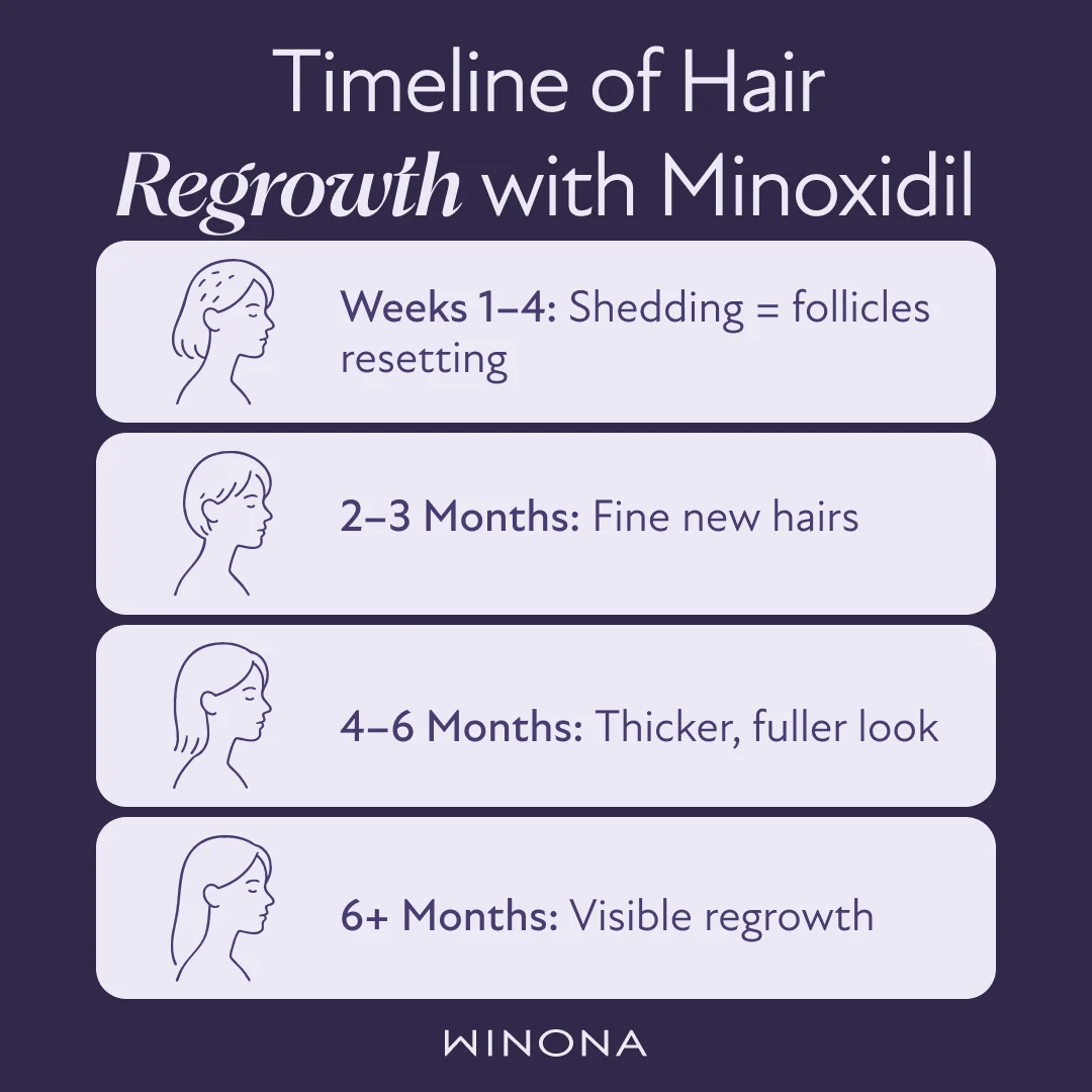 Timeline of Hair Regrowth with Minoxidil