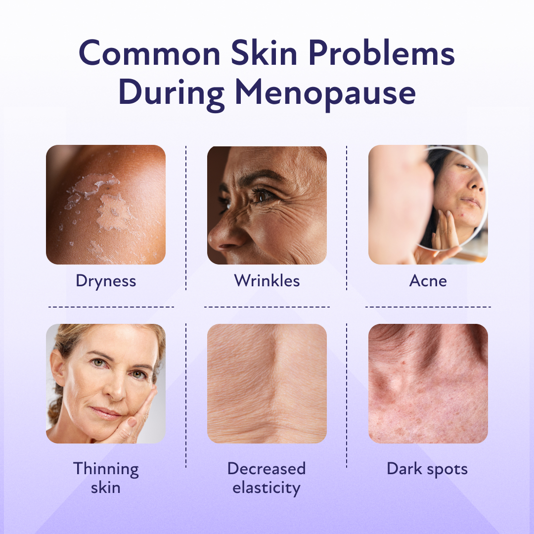 Menopause dry skin symptoms