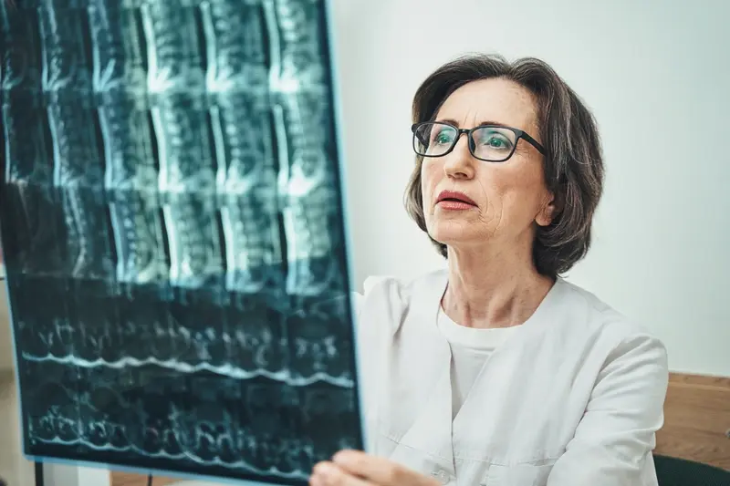 Osteoporosis during menopause