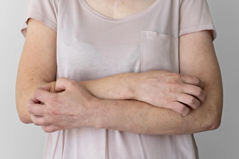menopausal itching symptom
