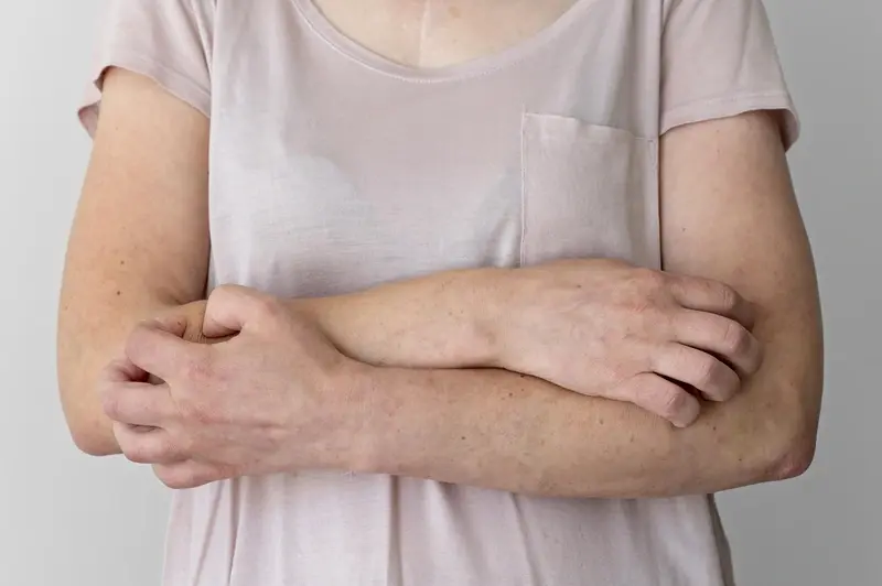 menopausal itching symptom