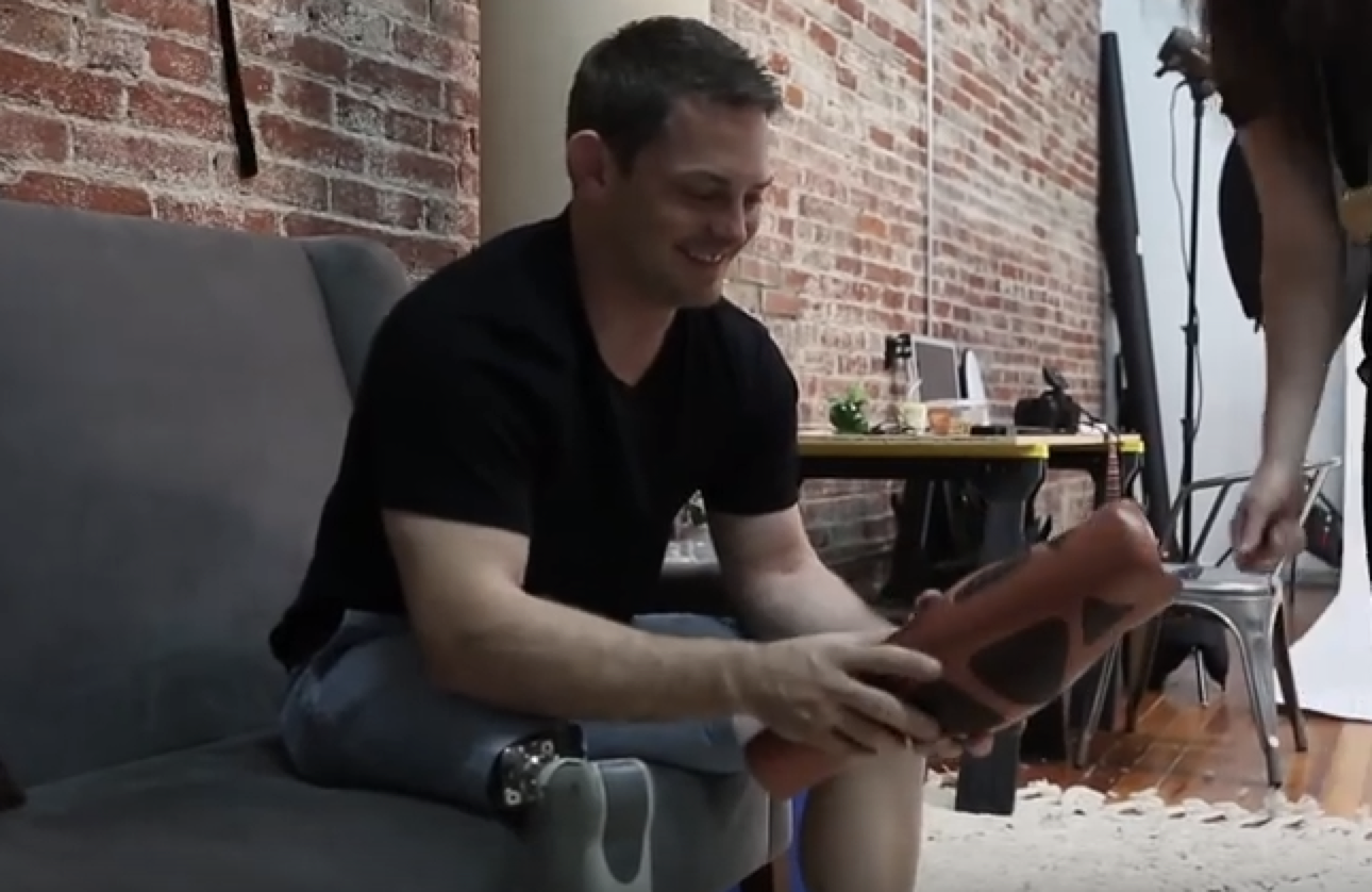 UNYQ photo of man holding prosthetic leg