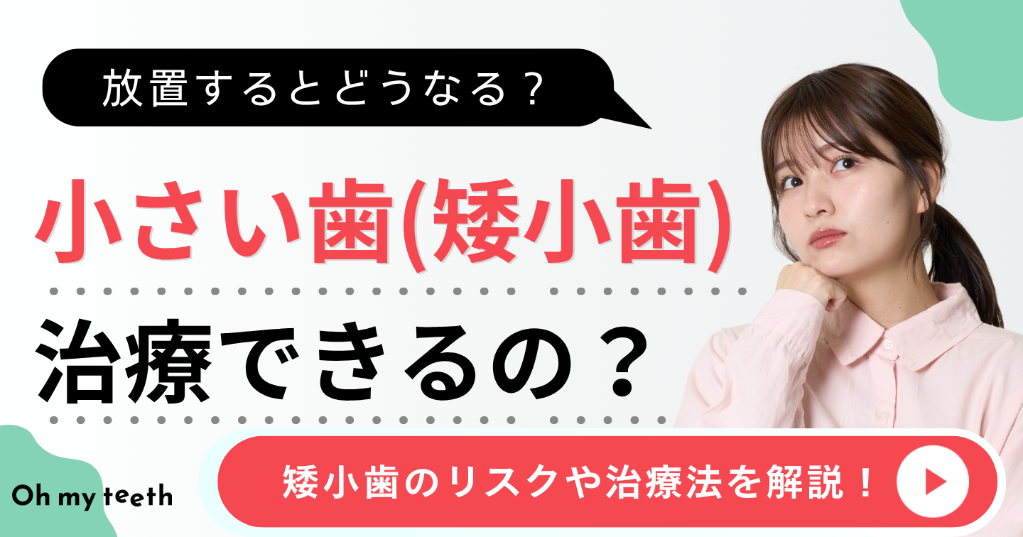 歯が小さい　アイキャッチ