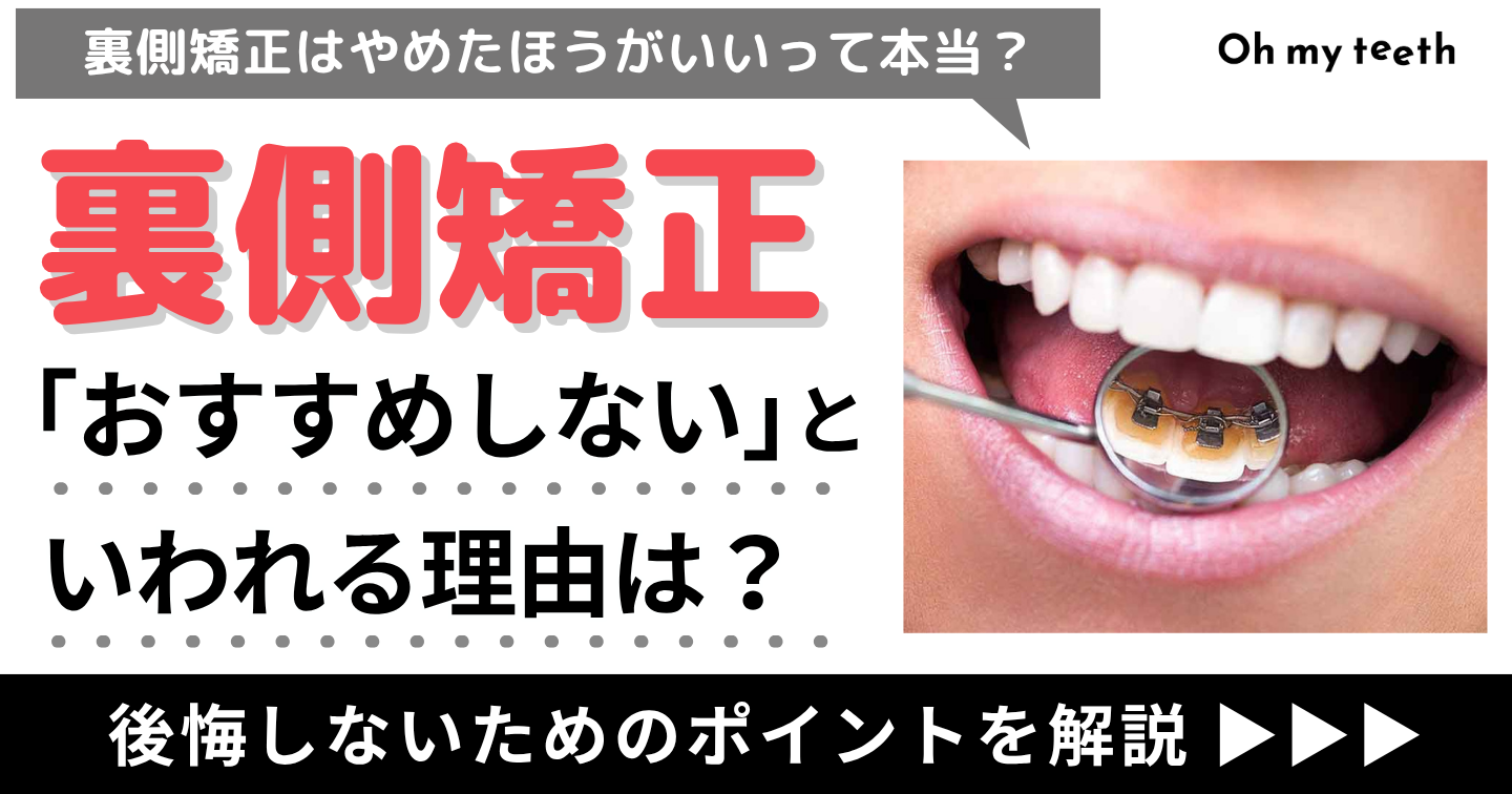 裏側矯正　おすすめしない　アイキャッチ