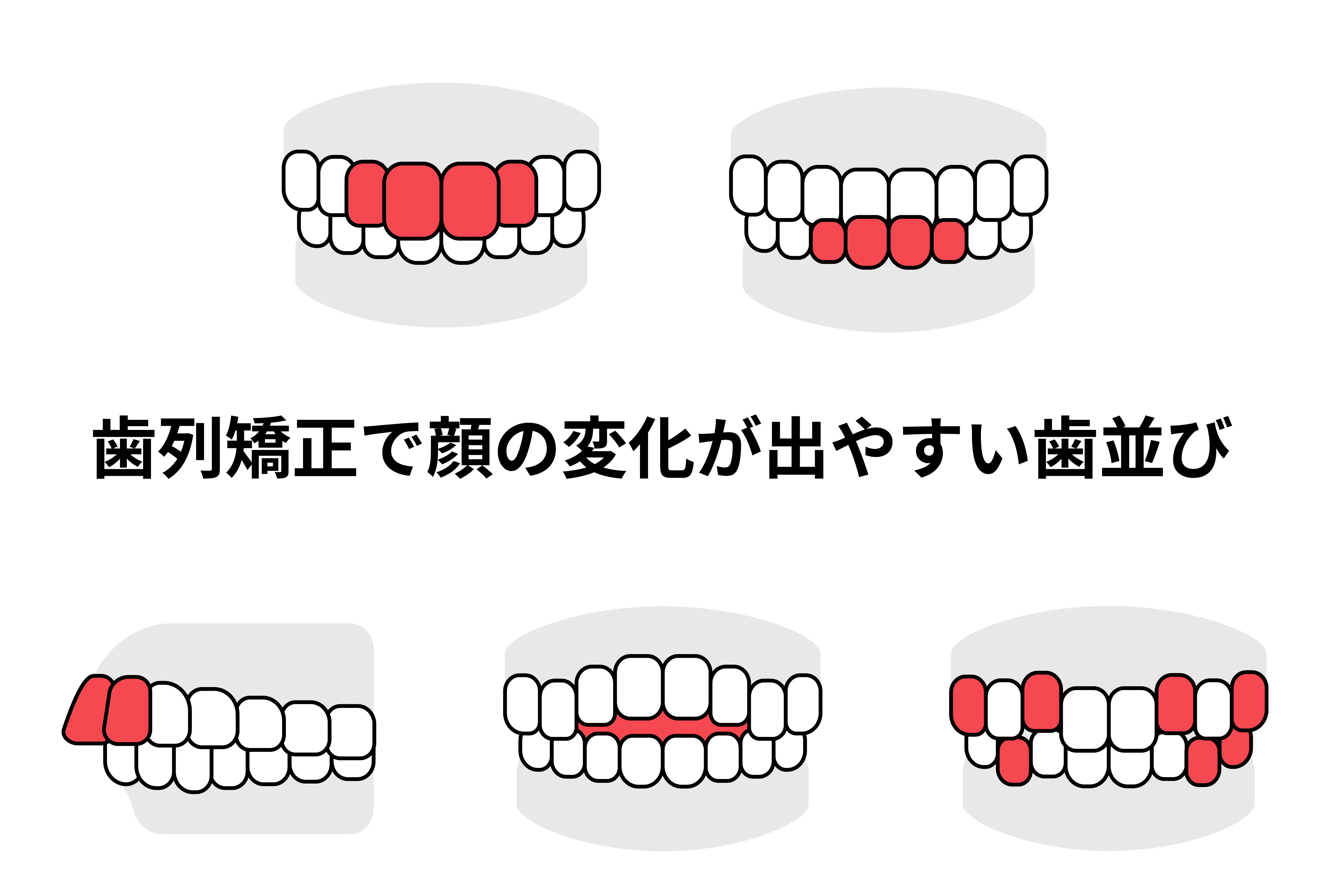歯列矯正で顔は変わる？期待できる5つの変化と注意点を解説