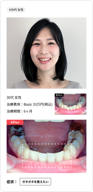 voice card07