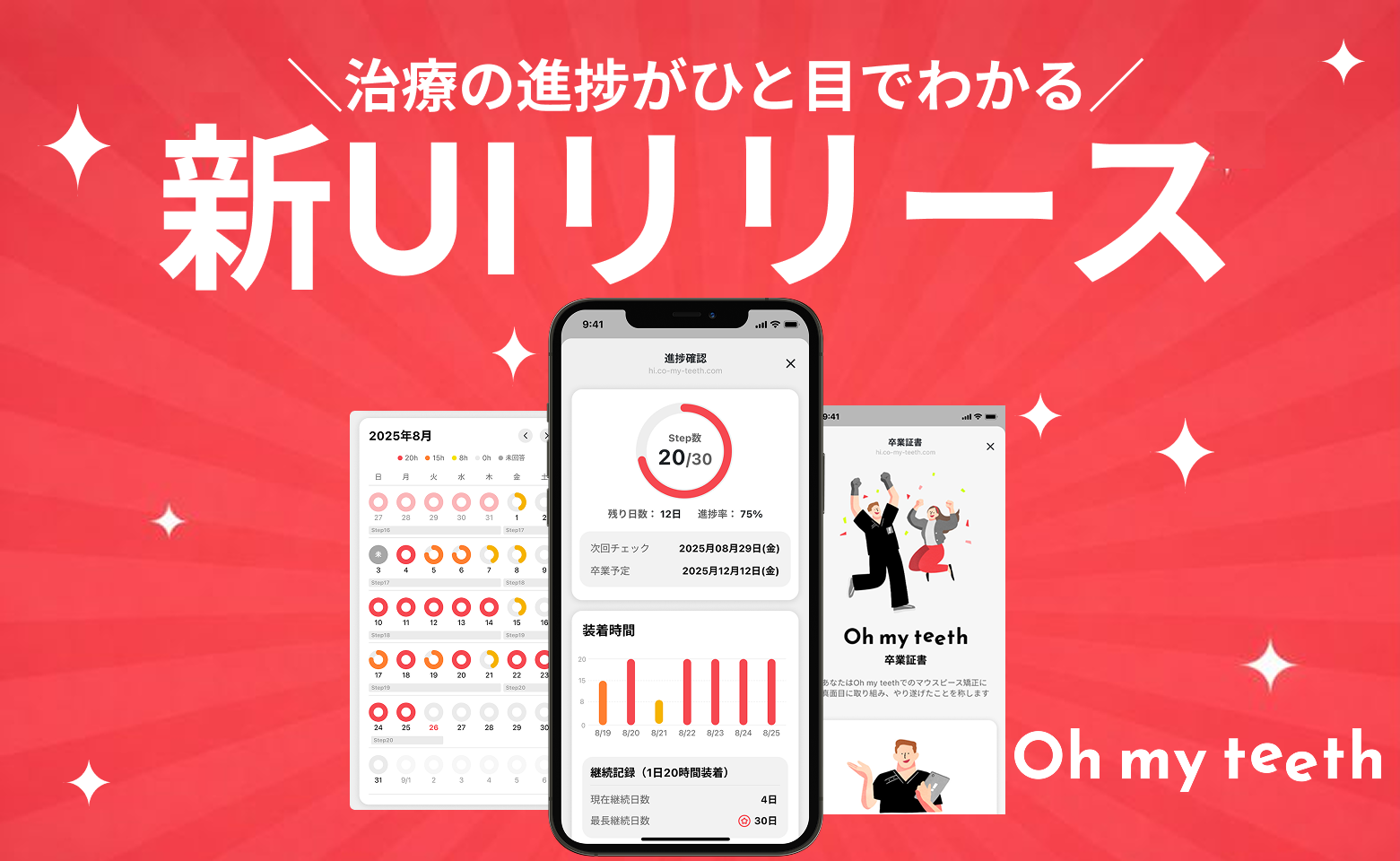 【新UIリリース】“終わりが見えない”矯正からの脱却｜Oh my teeth、治療の進捗がひと目でわかる新UIを提供開始アイキャッチ