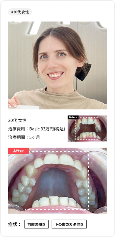 voice card04