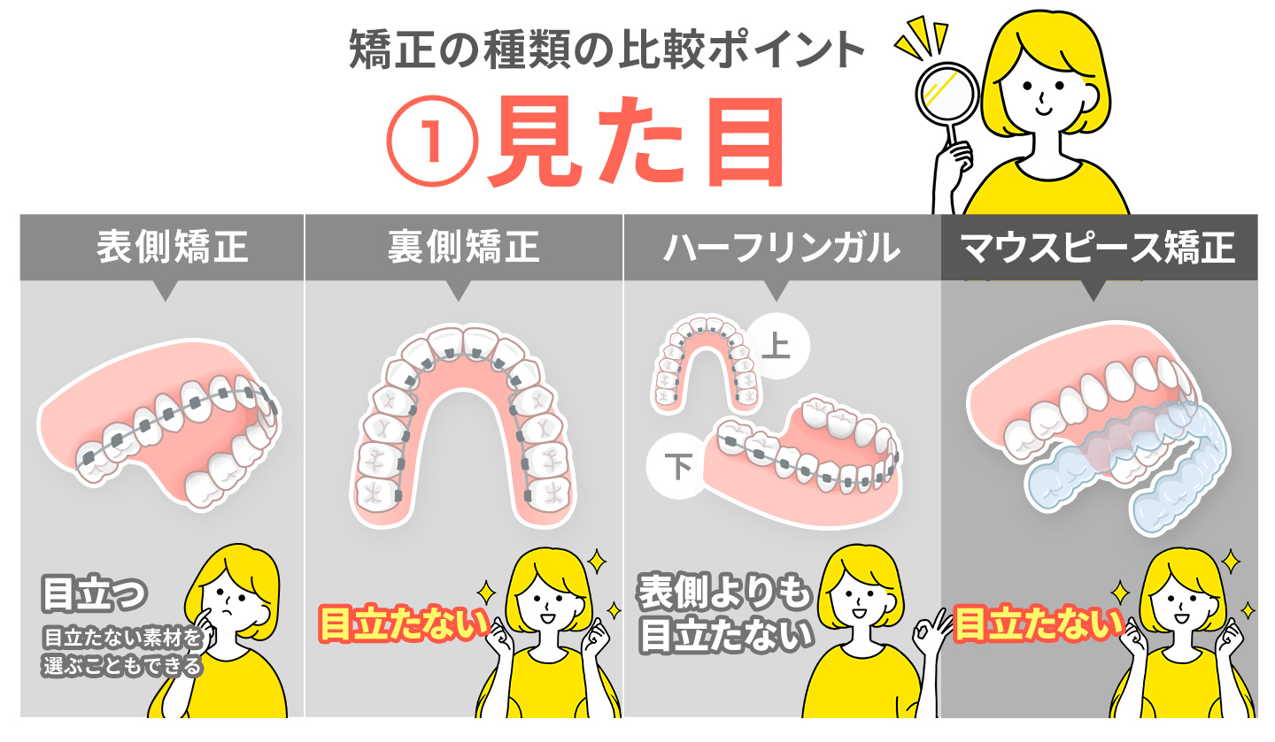 大人の歯科矯正の種類を比較するポイ�ント①見た目