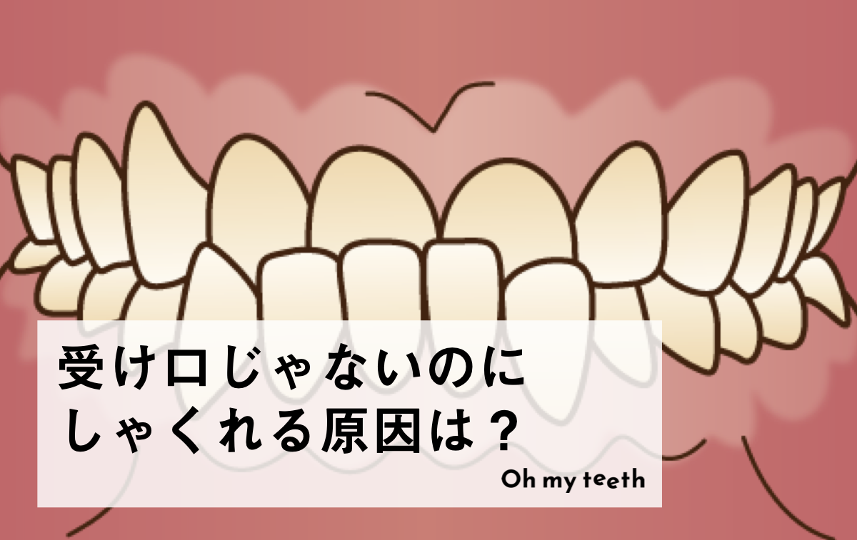 受け口じゃないのにしゃくれる原因は？