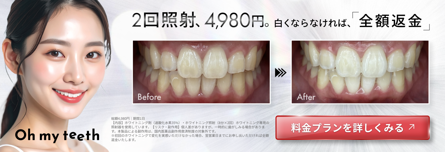 オフィスホワイトニングバナー（4980円・全額返金訴求）