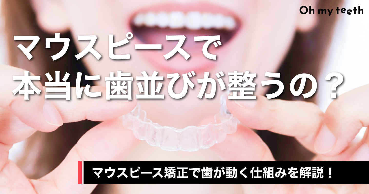 マウスピース矯正の仕組みを歯科医師が徹底解説！なぜ歯が動くの？