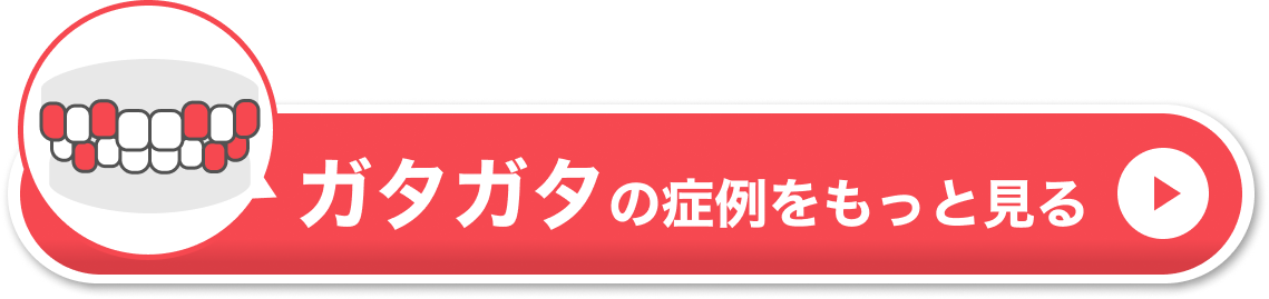 ガタガタの症例をもっと見る