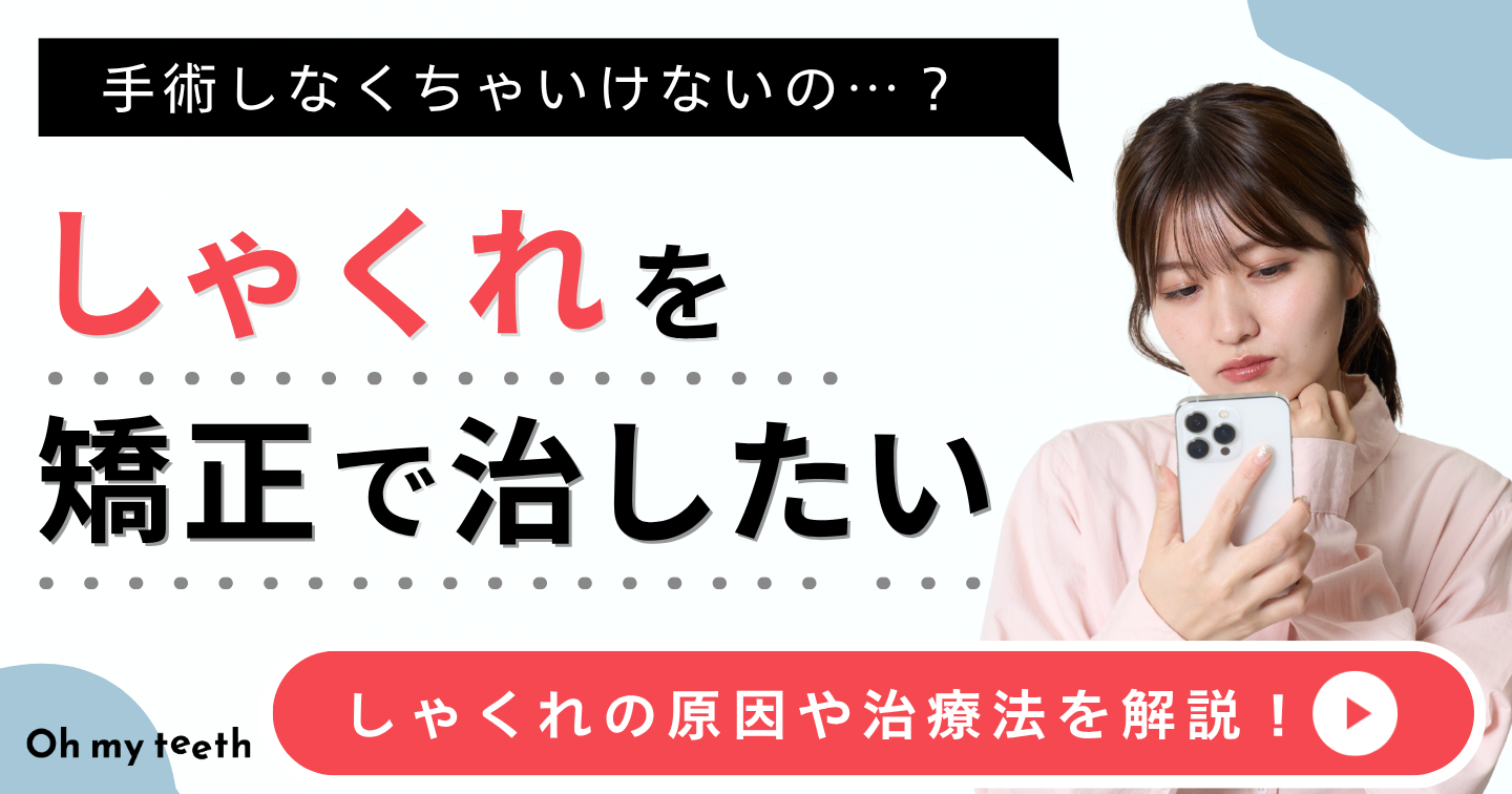 しゃくれ　アイキャッチ