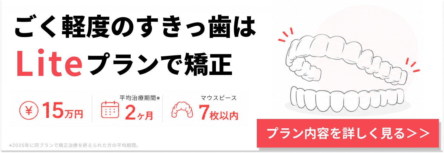 Liteプラン記事遷移バナー（すきっ歯版）