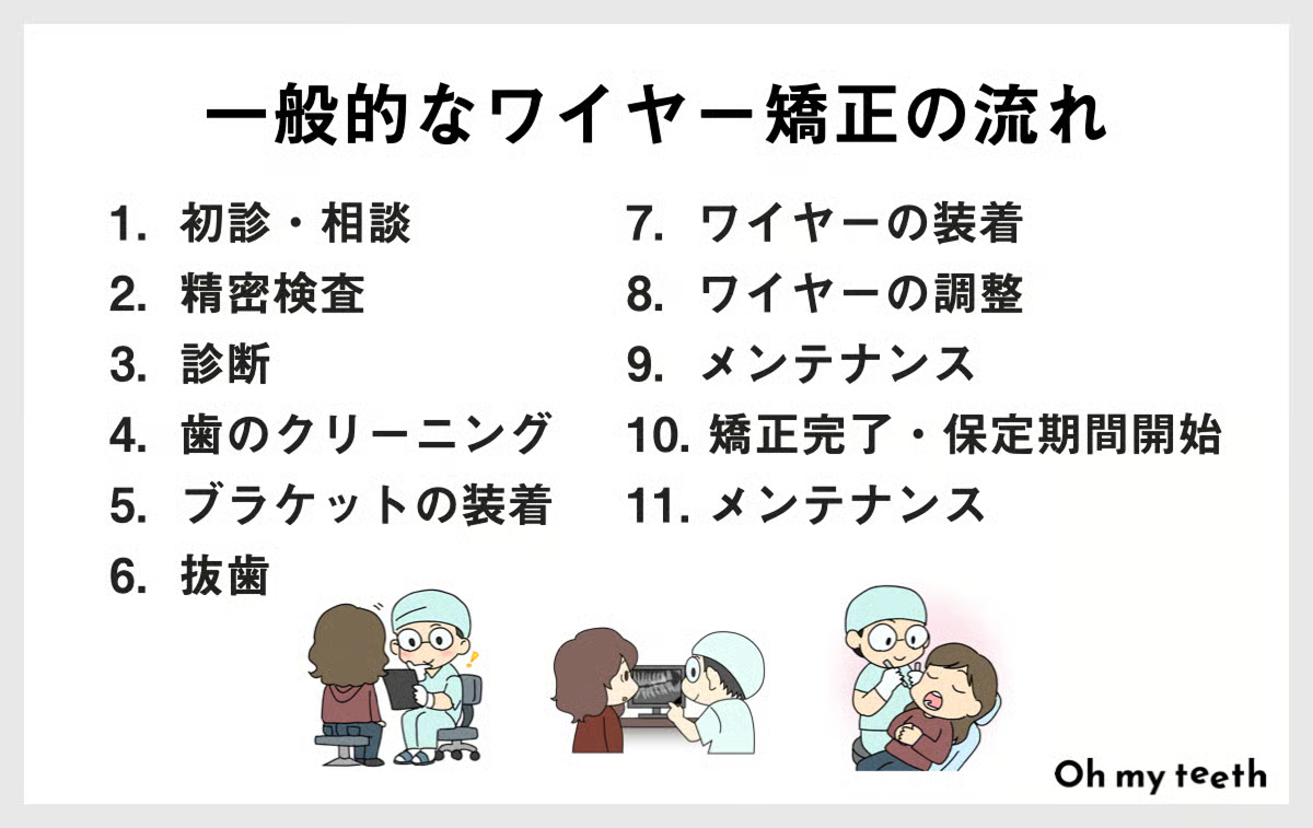 ワイヤー矯正の流れ