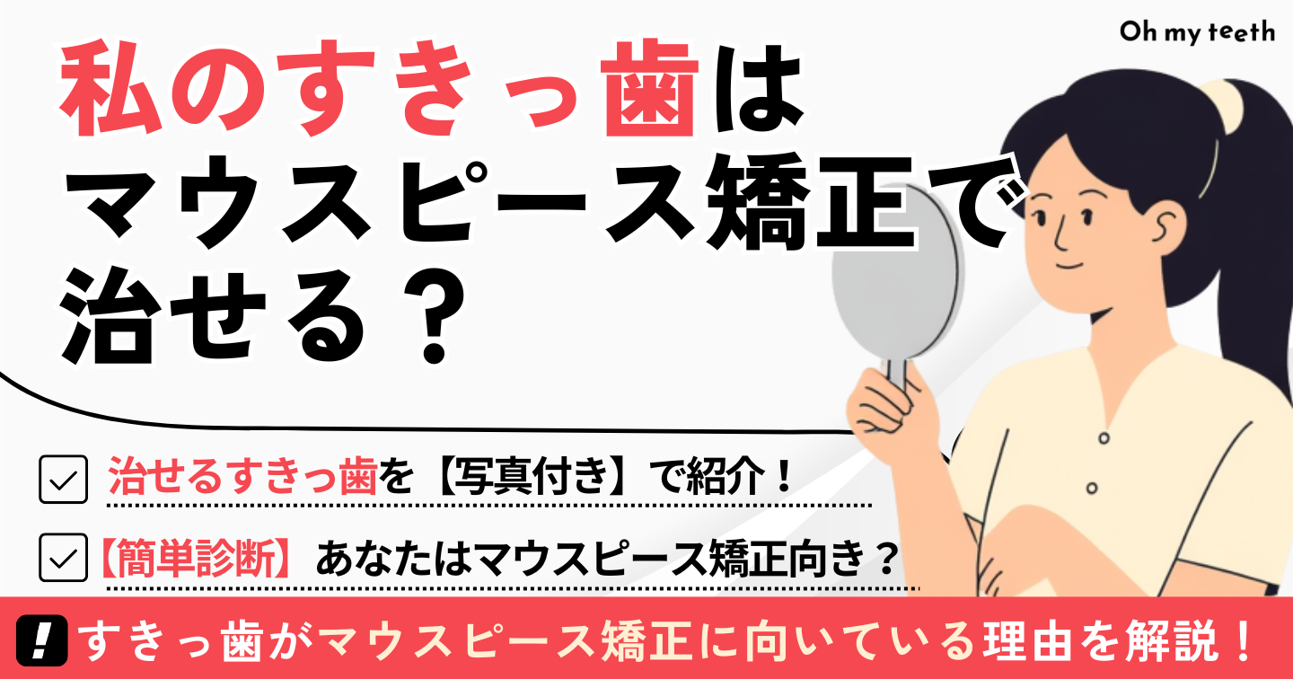 マウスピース矯正 すきっ歯
