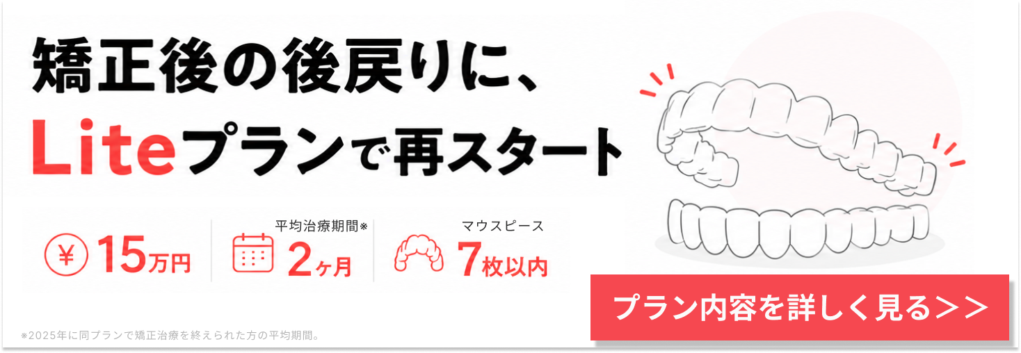 Liteプラン記事遷移バナー