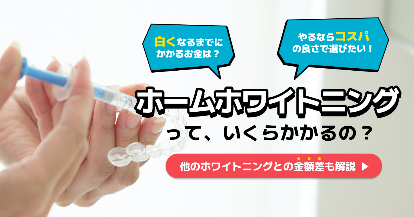 ホームホワイトニングの値段の相場は？ほかのホワイトニングとの比較も 