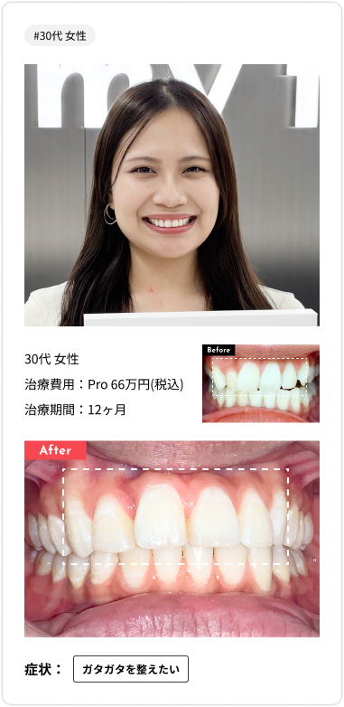 voice card08
