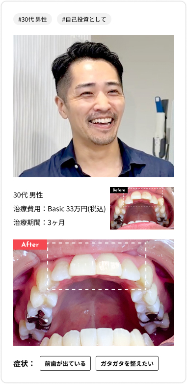 voice card03