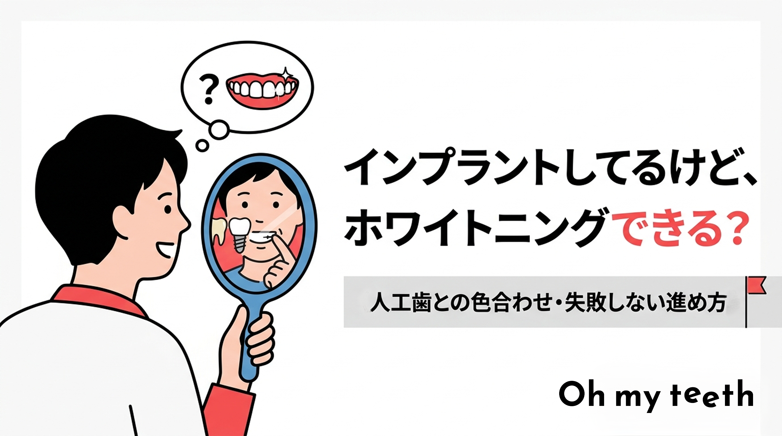 インプラント ホワイトニング アイキャッチ