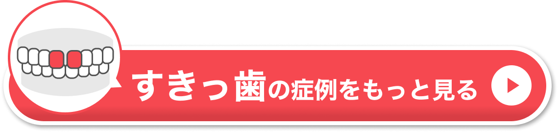 すきっ歯の症例をもっと見る