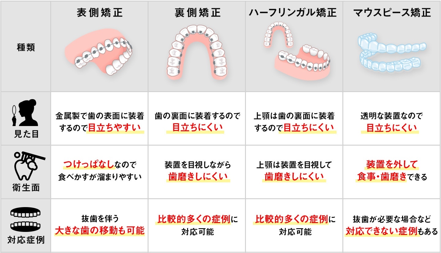 歯列矯正の種類別の特徴の違い：比較