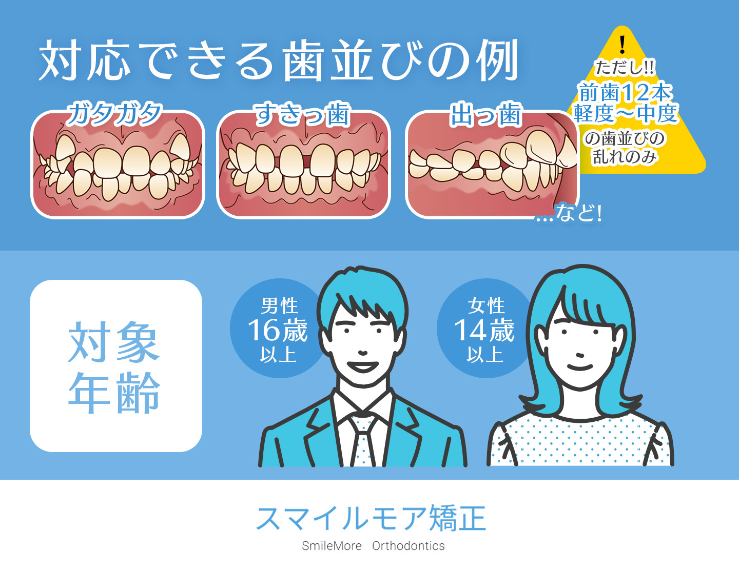 スマイルモア矯正の適応症例と対象年齢