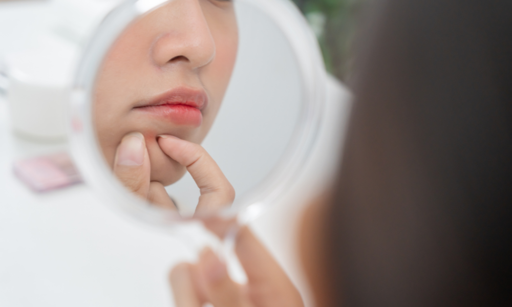 アデノイド顔貌 大人 治る アイキャッチ