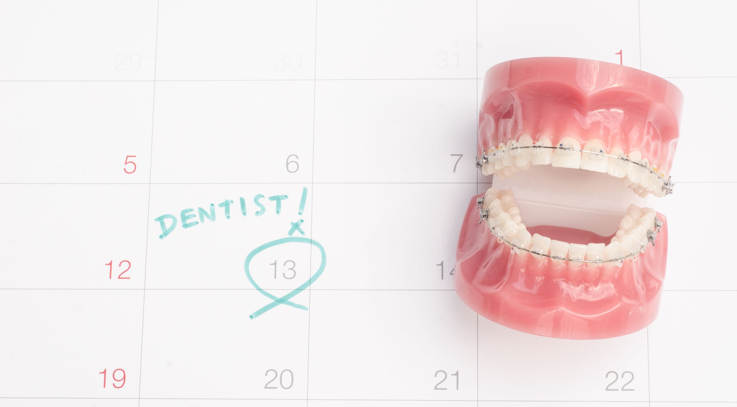 ワイヤー矯正の期間を表したイメージ