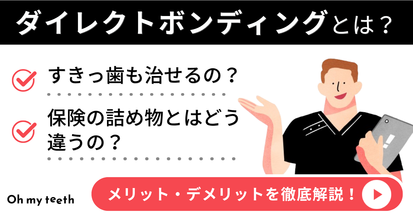 ダイレクトボンディング　アイキャッチ