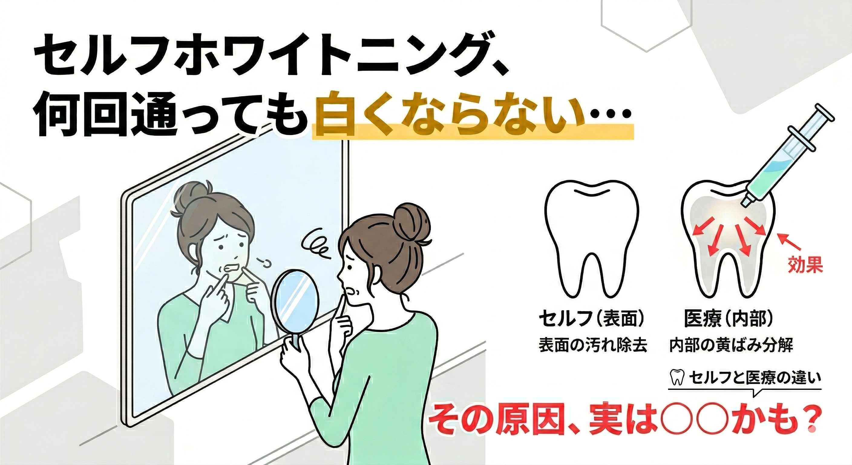 セルフホワイトニングで効果がないと感じるのはなぜ？白くならない理由 