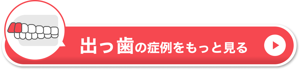 出っ歯の症例をもっと見る