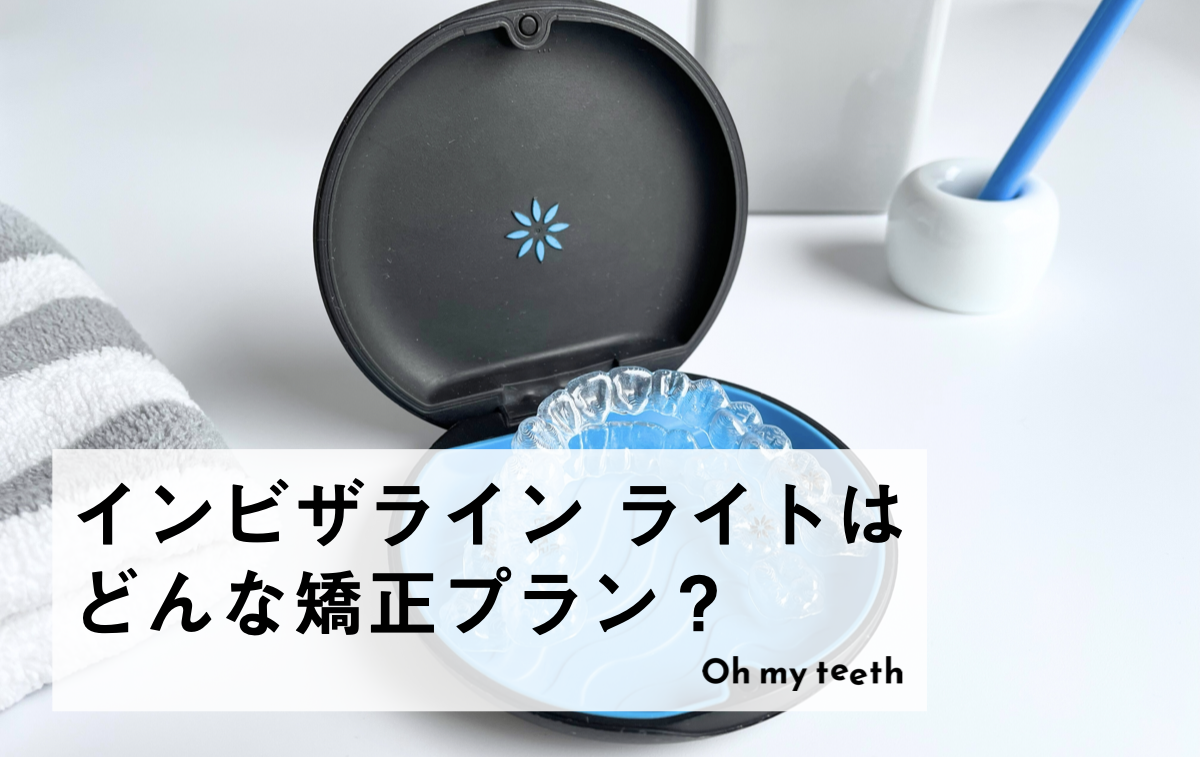 インビザライン ライトはどんな矯正プラン？