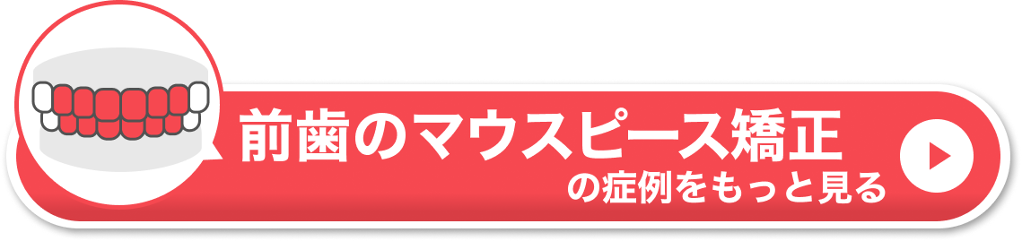 部分矯正　値段　CTA②