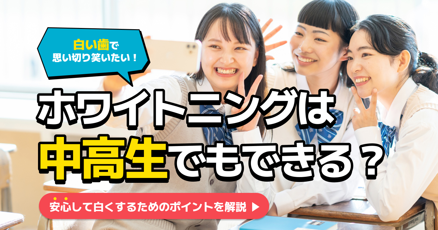 高校生や中学生でもホワイトニングはできる？値段や注意点を解説