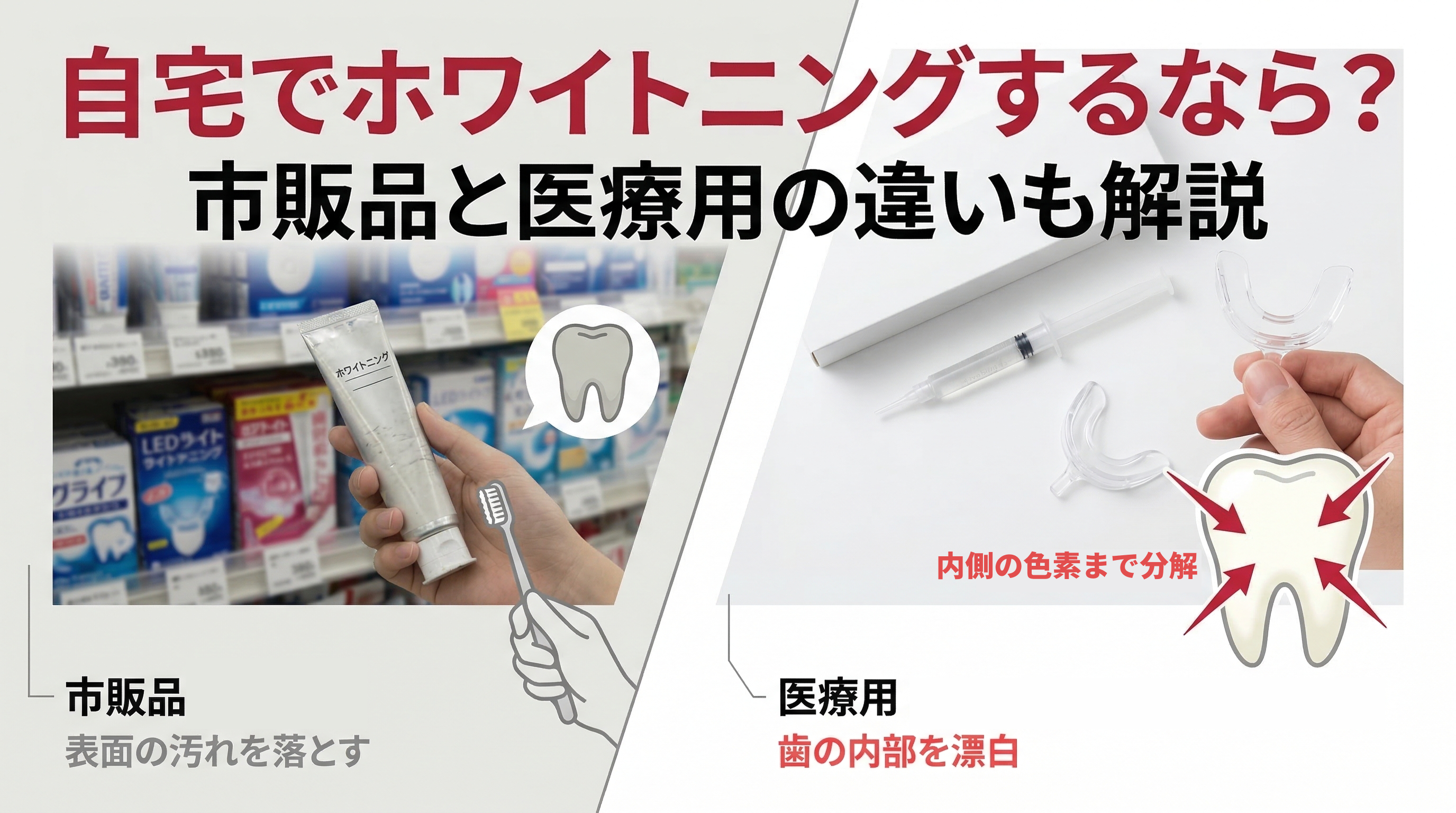 【自宅で本格ホワイトニング】本当に白くなるのはどれ?市販と歯医者の違い・通院不要のおすすめの選び方