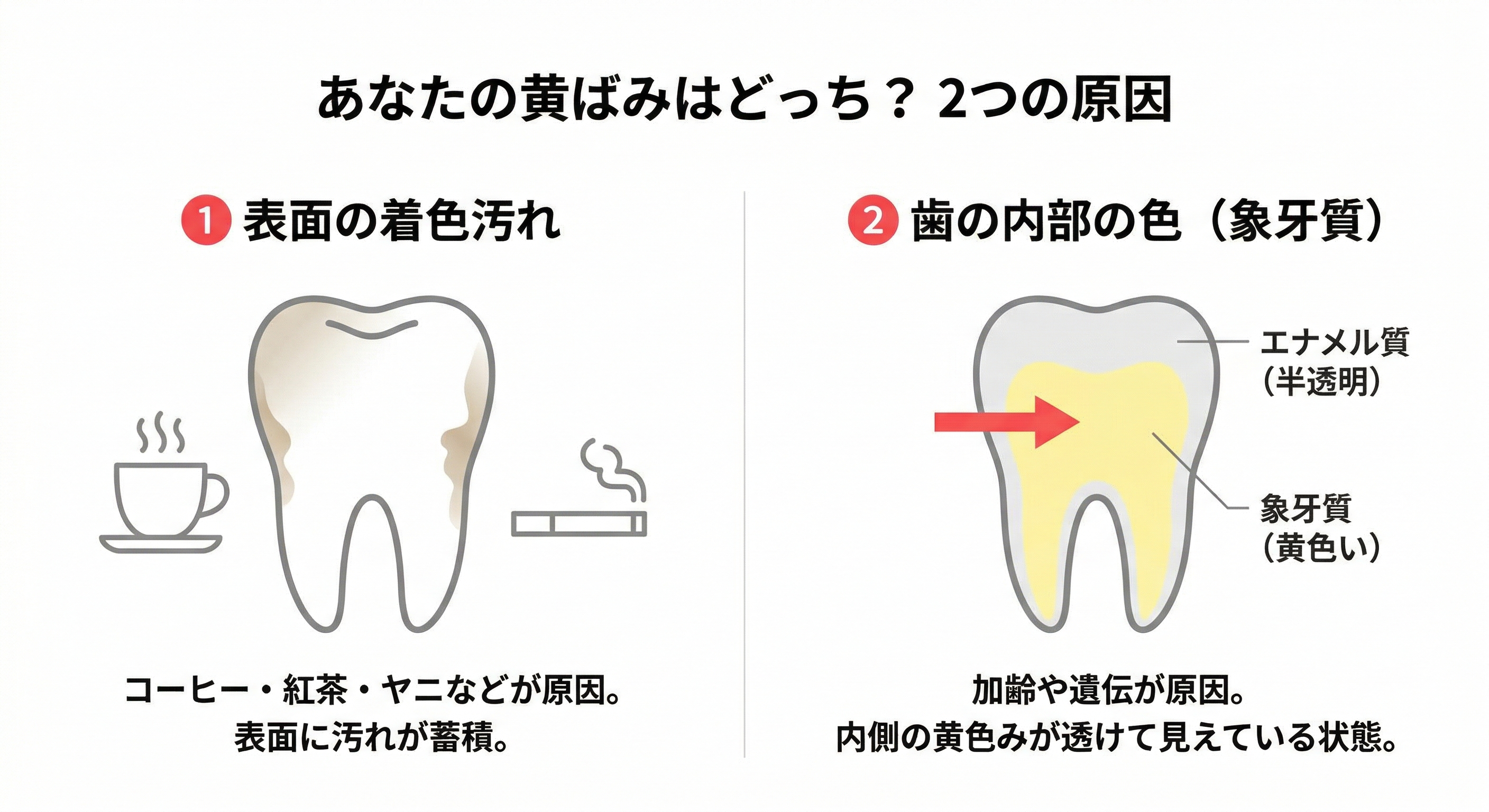 セルフホワイトニングで効果がないと感じるのはなぜ？白くならない理由 