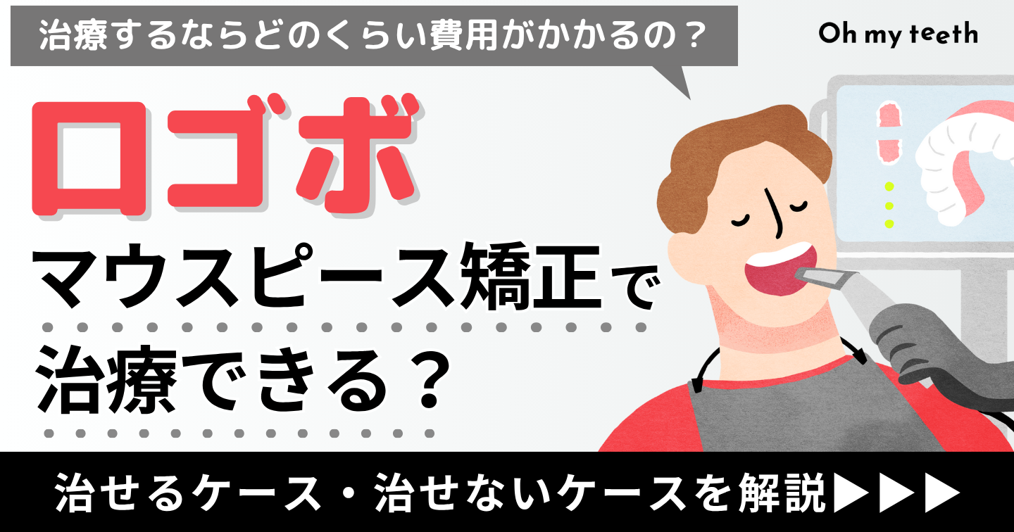 口ゴボ　マウスピース矯正　アイキャッチ