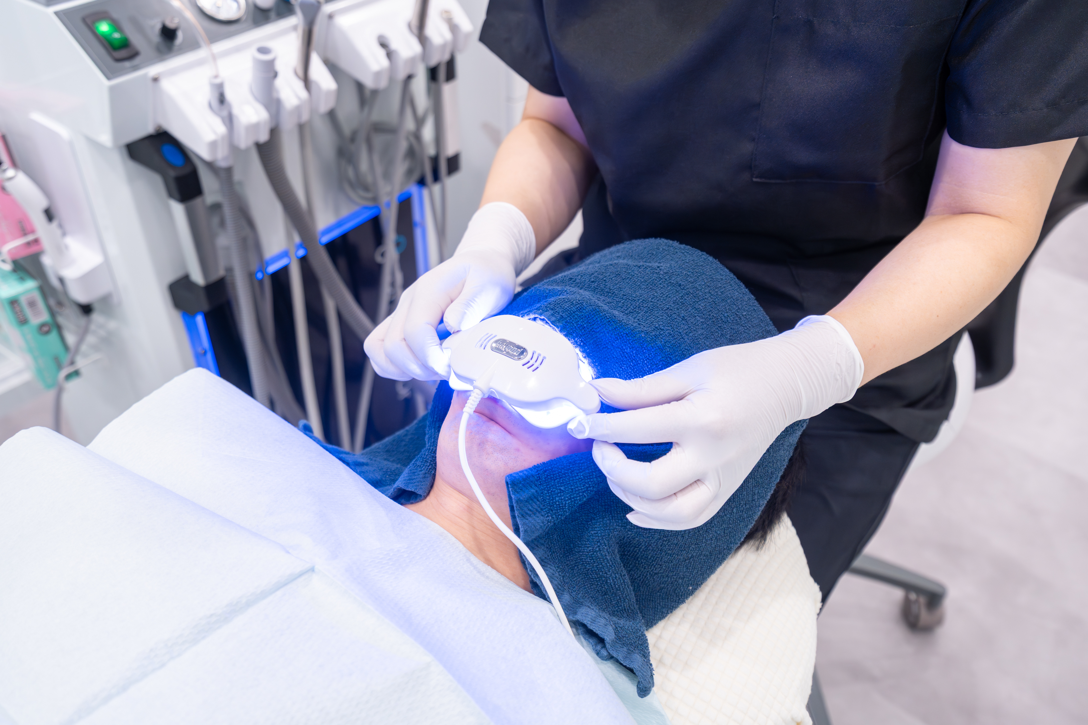 オフィスホワイトニングの施術シーン