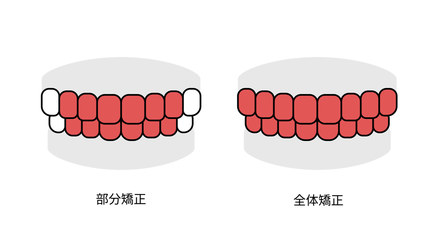 部分と全体の比較画像
