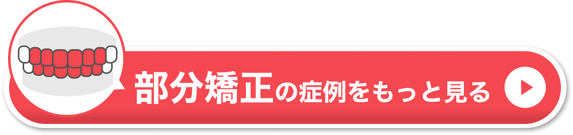 部分矯正できない例　CTA①